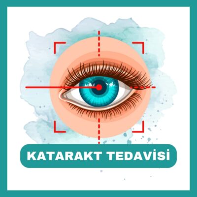 Katarakt Ameliyatı