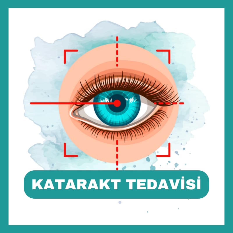 Katarakt Ameliyatı